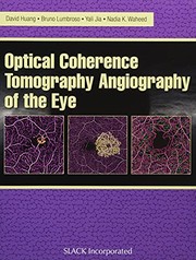 Optical Coherence Tomography Angiography of the Eye