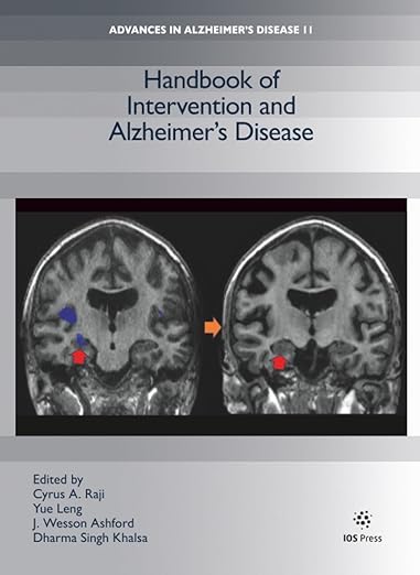Handbook of Intervention and Alzheimer's Disease