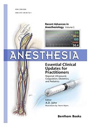 Anesthesia