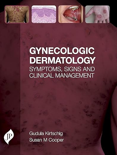 Gynecologic Dermatology