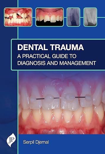 Dental Trauma Hb