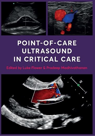 Point-Of-Care Ultrasound in Critical Care