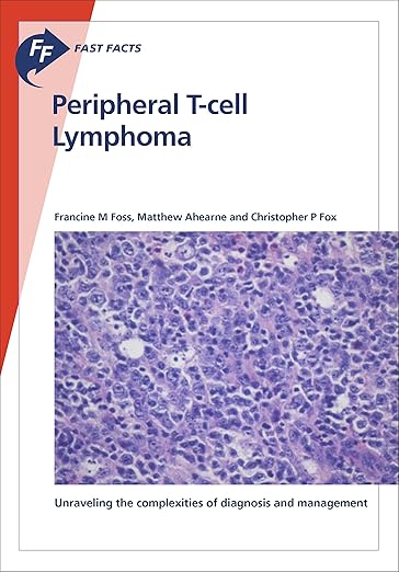 Fast Facts : Peripheral T-Cell Lymphoma