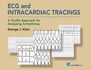 ECG and Intracardiac Tracings