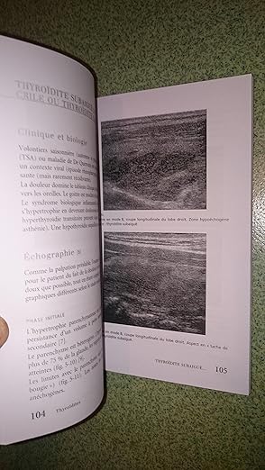 Échographie de la Thyroïde