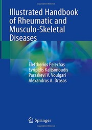 Illustrated Handbook of Rheumatic and Musculo-Skeletal Diseases