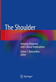 The Shoulder