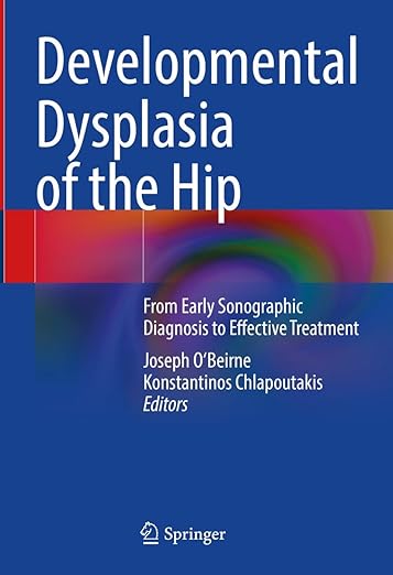 Developmental Dysplasia of the Hip