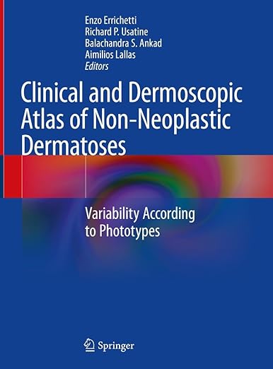 Clinical and Dermoscopic Atlas of Non-Neoplastic Dermatoses