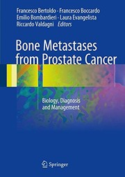 Bone Metastases from Prostate Cancer