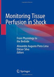 Monitoring Tissue Perfusion in Shock