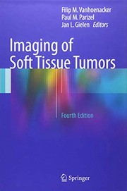 Imaging of Soft Tissue Tumors