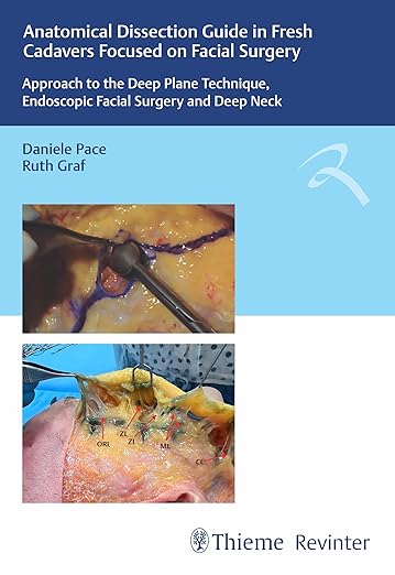 Anatomical Dissection Guide in Fresh Cadavers Focused on Fac