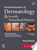 Illustrated Synopsis of Dermatology & Sexually Transmitted Diseases - E-Book