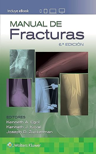 Manual de Fracturas