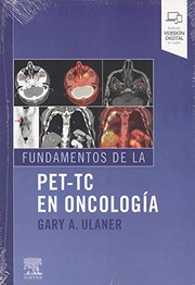Fundamentos de la PET-TC en oncología
