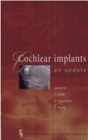 Cochlear implants