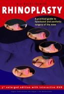 Rhinoplasty- Text