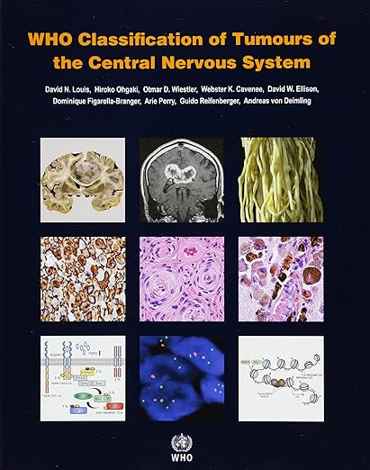 WHO Classification of Tumours of the Central Nervous System