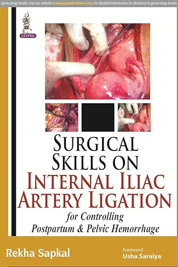 Surgical Skills on Internal Iliac Artery Ligation for Controlling Postpartum and Pelvic Hemorrhage