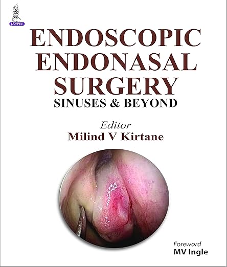 Endoscopic Endonasal Surgery - Sinuses and Beyond