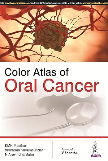 Atlas of Oral Cancer