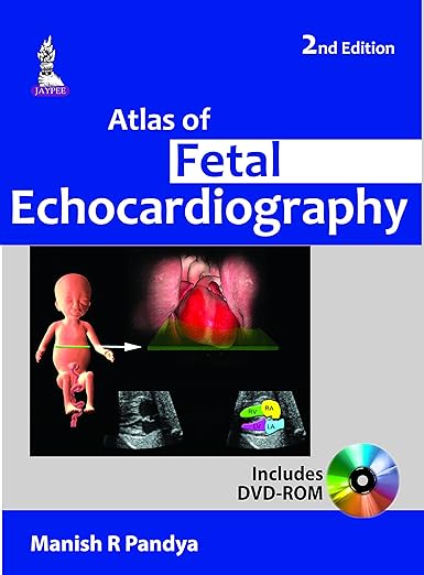 Atlas of Fetal Echocardiography
