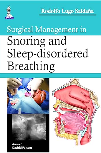 Surgical Management in Snoring and Sleep-Disordered Breathing