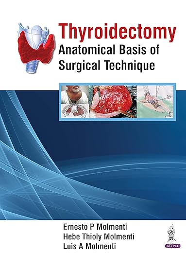 Thyroidectomy