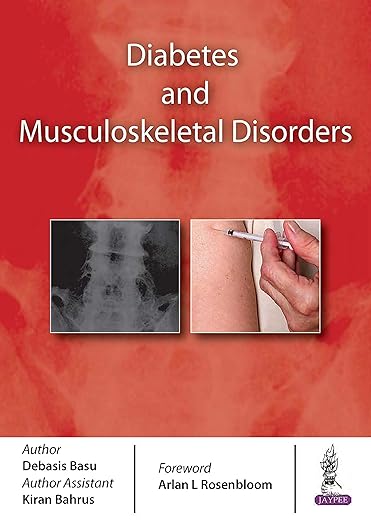 Diabetes and Musculoskeletal Disorders