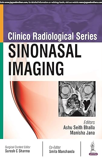 Sinonasal Imaging