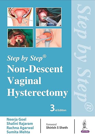 Non-Descent Vaginal Hysterectomy