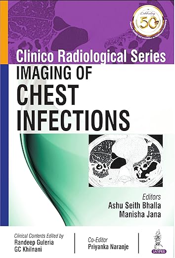 Imaging of Chest Infections