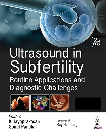 Ultrasound in Subfertility