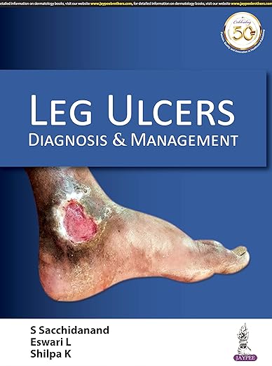 Leg Ulcers