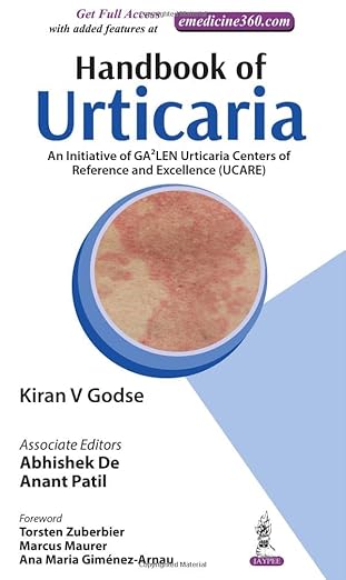 Handbook of Urticaria
