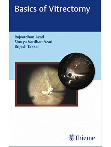 Basics of Vitrectomy