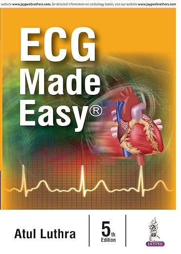 ECG Made Easy
