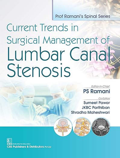 Current Trends in Surgical Management of Lumbar Canal Stenosis