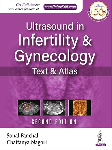 Ultrasound in Infertility and Gynecology