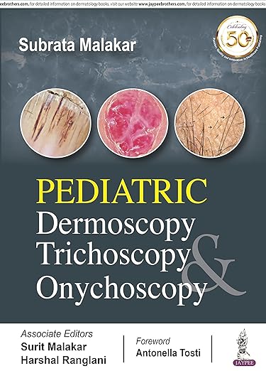 Pediatric Dermoscopy Trichoscopy and Onychoscopy