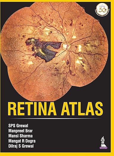 Retina Atlas