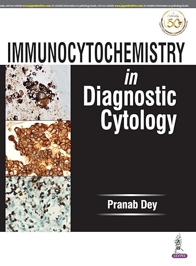 Immunocytochemistry Diagnostic Cytolog