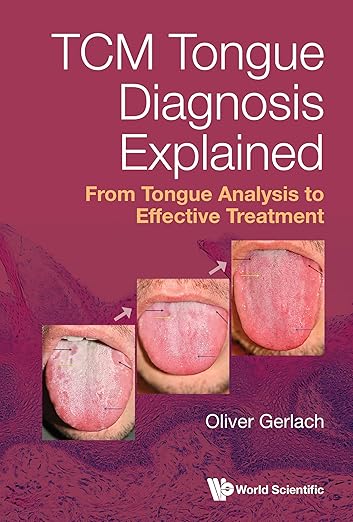 Tcm Tongue Diagnosis Explained Hb