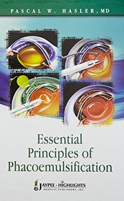 Essential Principles of Phacoemulsification