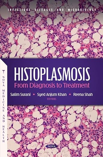 Histoplasmosis