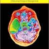 Arachnoid Cysts: Clinical and Surgical Management-Original PDF