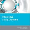 Interstitial Lung Disease, 1e – Original PDF