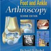 Foot & Ankle Arthroscopy Second edition-EPUB
