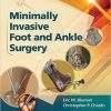Minimally Invasive Foot & Ankle Surgery (Minimally Invasive Orthopaedic Surgery)-EPUB